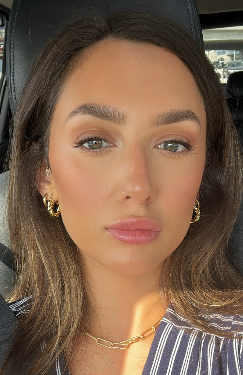 EED202612508 - Egg Donor